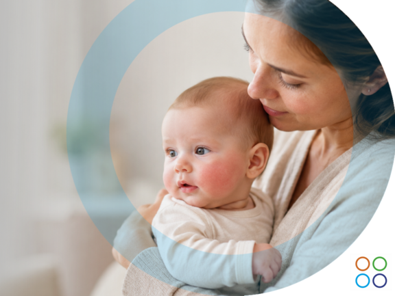 Alergias en bebés: Las preguntas más frecuentes