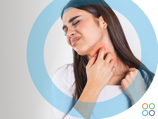 Urticaria Crónica Espontánea: una afección que va más allá del picor
