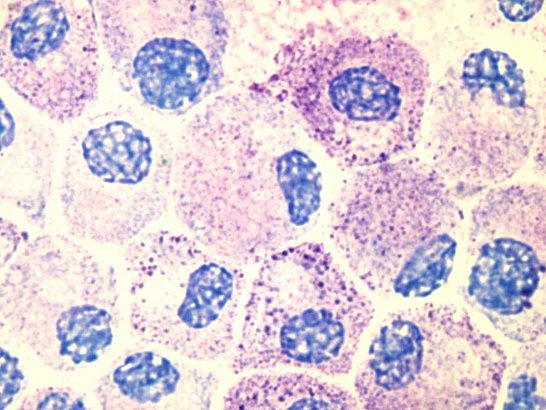 Mastocitos teñidos con azul de toluidina