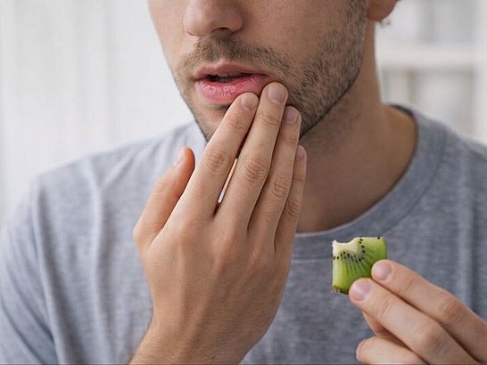 Persona joven tocándose los labios con leve irritación mientras sostiene un trozo de fruta
